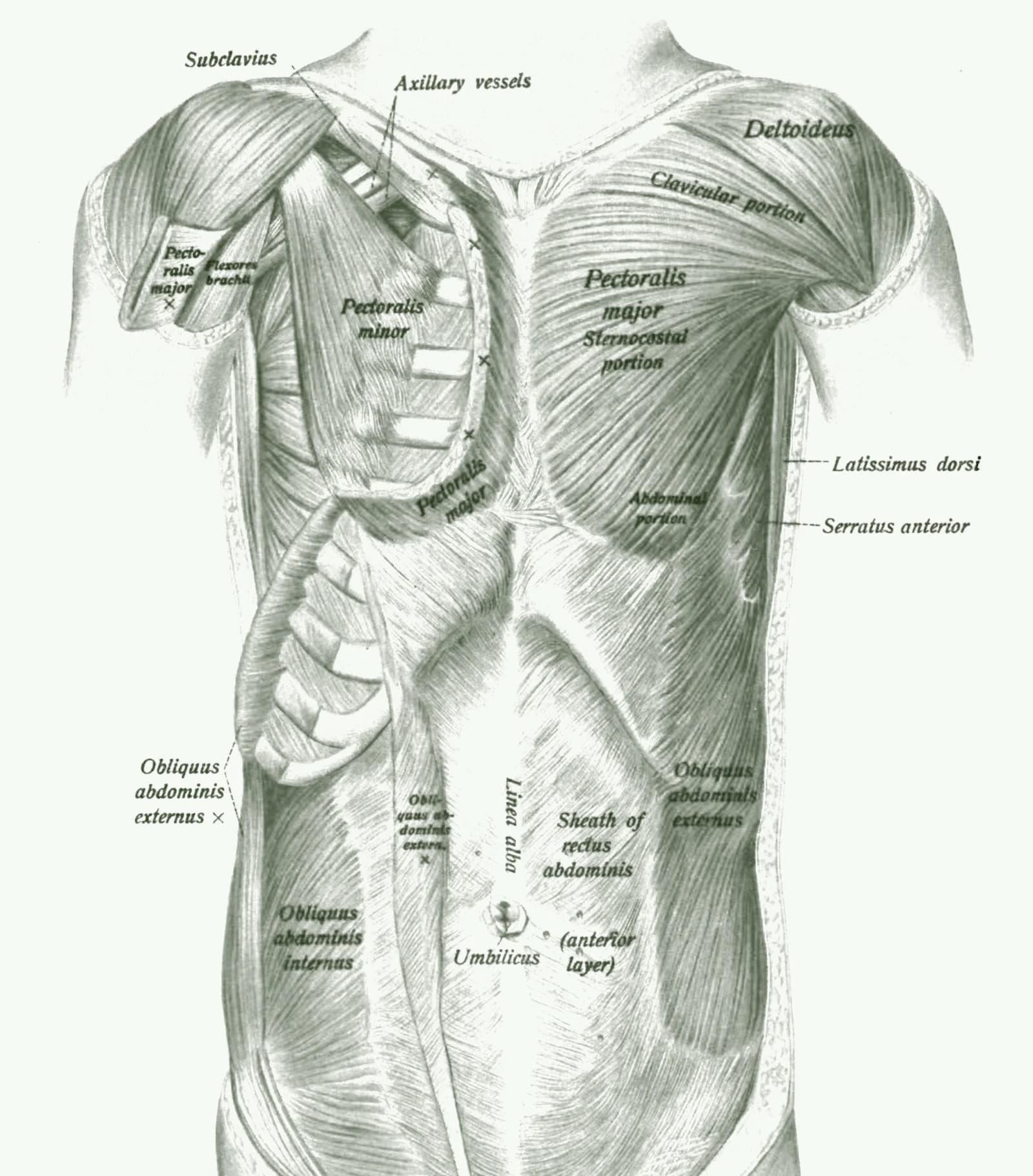Anatomische Tafel der vorderen Rumpfmuskulatur mit markierten Regionen, in denen Triggerpunkte häufig auftreten
